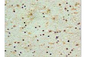Immunohistochemistry of paraffin-embedded human brain tissue using ABIN7148846 at dilution of 1:100 (CDK1 antibody  (AA 1-283))