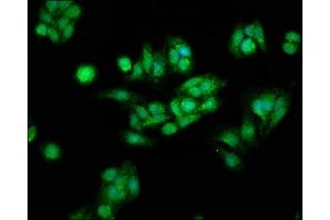 Immunofluorescence staining of HepG2 cells with ABIN7146984 at 1:166, counter-stained with DAPI. (CTNNB1 antibody  (AA 2-781))