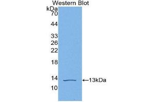 Western Blotting (WB) image for anti-Complement Component C4b (C4b) (AA 680-756) antibody (ABIN1866970) (C4B antibody  (AA 680-756))