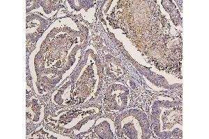 IHC analysis of IRS1 using anti-IRS1 antibody (ABIN7599659). (IRS1 antibody  (AA 1041-1242))