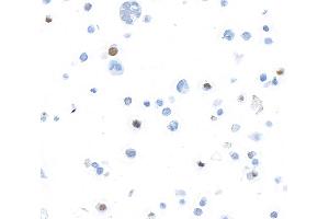 Immunocytochemistry (ICC) image for anti-Forkhead Box P3 (FOXP3) (AA 275-325) antibody (ABIN7455209) (Recombinant FOXP3 antibody  (AA 275-325))