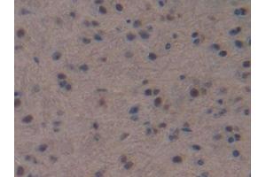 IHC-P analysis of Mouse Brain Tissue, with DAB staining. (NPPC antibody  (AA 30-126))