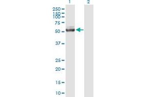 Western Blot analysis of IQCB1 expression in transfected 293T cell line by IQCB1 MaxPab polyclonal antibody. (IQCB1 antibody  (AA 1-465))