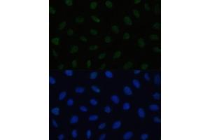 Immunofluorescence analysis of U2OS cells using HSF1 antibody (ABIN6131141, ABIN6142021, ABIN6142022 and ABIN6217875) at dilution of 1:100. (HSF1 antibody  (AA 350-529))