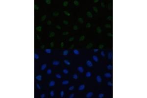 Immunofluorescence analysis of U2OS cells using HSF1 antibody (ABIN6131141, ABIN6142021, ABIN6142022 and ABIN6217875) at dilution of 1:100. (HSF1 antibody  (AA 350-529))
