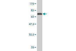 Western Blot detection against Immunogen (62. (PLAUR antibody  (AA 1-335))