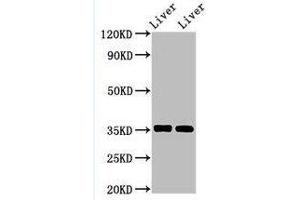 Western Blotting (WB) image for anti-Arginase, Liver (ARG1) (AA 1-322) antibody (ABIN6091459) (Liver Arginase antibody  (AA 1-322))
