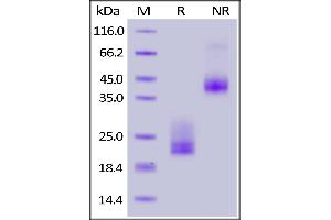 Biotinylated Human CD3E&CD3D Heterodimer Protein, His,Avitag&Tag Free on  under reducing (R) and ing (NR) conditions. (CD3D & CD3E (AA 23-126) (Active) protein (His tag,AVI tag,Biotin))