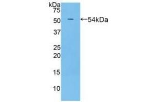 Detection of Recombinant PZP, Rat using Polyclonal Antibody to Pregnancy Zone Protein (PZP) (PZP antibody  (AA 1251-1500))