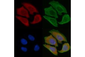 ABIN6256920 and ABIN6273415 staining Hela cells(45 min of heat-shock) by IF/ICC.