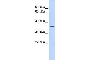 WB Suggested Anti-MMP23B Antibody Titration:  0. (MMP23B antibody  (Middle Region))