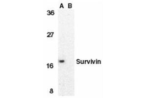 Western blot analysis of survivin in MOLT4 cell lysate in the absence (A) or presence (B) of blocking peptide with this product at 1 μg/ml.