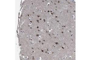 Immunohistochemical staining of human cerebral cortex with CCDC34 polyclonal antibody  shows moderate nuclear membrane positivity in neuronal cells at 1:500-1:1000 dilution.