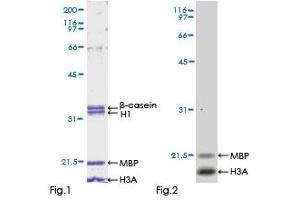 Kinase Activity Assay (KAA) image for Unc-51-Like Kinase 4 (ULK24) (AA 1-580) protein (GST tag) (ABIN1324629) (ULK4 Protein (AA 1-580) (GST tag))