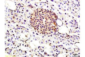Formalin-fixed and paraffin embedded rat kidney labeled with Anti-TBRG1 Polyclonal Antibody, Unconjugated (ABIN706151) at 1:200 followed by conjugation to the secondary antibody and DAB staining