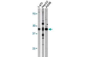 The E2F1 (phospho S337) polyclonal antibody  is used in Western blot to detect Phospho-E2F1-S337 in T-47D (left), HepG2 (middle), and A2058 (right) cell lysates