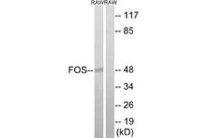 Western blot analysis of extracts from RAW264. (c-FOS antibody  (AA 201-250))