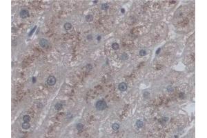 Detection of CD209 in Human Liver Tissue using Polyclonal Antibody to Cluster Of Differentiation 209 (CD209) (DC-SIGN/CD209 antibody  (AA 70-404))