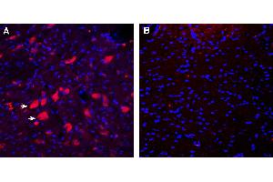 Expression of CD157 in rat deep cerebellar nuclei.