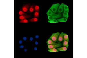 ABIN7095901 and ABIN7099963 staining Hela cells by IF/ICC.