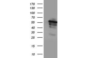 HEK293T cells were transfected with the pCMV6-ENTRY control (Left lane) or pCMV6-ENTRY CYP2A6 (Right lane) cDNA for 48 hrs and lysed. (CYP2A6 antibody)