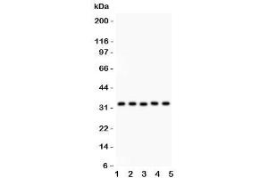Western blot testing of HO-1 antibody and Lane 1:  human placenta (HMOX1 antibody  (AA 1-288))