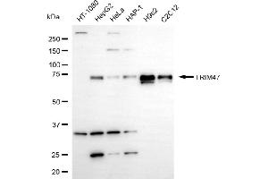 Western blotting analysis using TRIM47 antibody (ABIN7800635). (TRIM47 antibody)