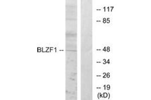 Western blot analysis of extracts from Jurkat cells, using BLZF1 Antibody. (BLZF1 antibody  (AA 10-59))