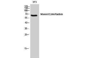 Western Blotting (WB) image for anti-Moesin/ezrin/radixin (Ser105) antibody (ABIN3176064) (Moesin/ezrin/radixin (Ser105) antibody)