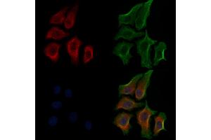 ABIN6256204 and ABIN6267563 staining HepG2 cells(30 min of 4uM Forskolin treatment) by IF/ICC. (RPS6 antibody  (pSer235))