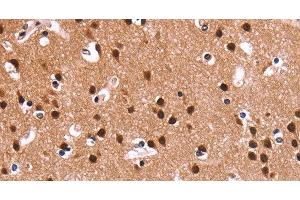 Immunohistochemistry of paraffin-embedded Human brain using RPSA Polyclonal Antibody at dilution of 1:60 (RPSA/Laminin Receptor antibody)