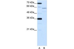 WB Suggested Anti-NOVA2 Antibody Titration:  2.