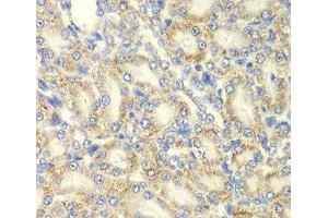 Immunohistochemistry of paraffin-embedded Rat kidney using PRKAB2 Polyclonal Antibody at dilution of 1:100 (40x lens).