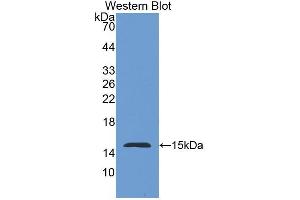 Western blot analysis of the recombinant protein. (Nephrin antibody  (AA 23-92))