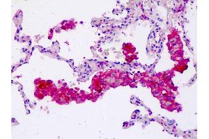 Anti-CORO6 antibody IHC staining of human lung, macrophages. (Coronin 6 antibody  (AA 337-365))