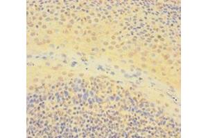Immunohistochemistry of paraffin-embedded human tonsil tissue using ABIN7150361 at dilution of 1:100 (IKZF1 antibody  (AA 1-265))