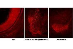 Immunofluorescence microscopy using  Protein A purified anti-Six3 antibody shows detection of Six3 in various E14. (SIX3 antibody  (Internal Region))