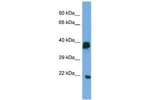 Host:  Rabbit  Target Name:  LIPT2  Sample Type:  Placenta lysates  Antibody Dilution:  1. (LIPT2 antibody  (C-Term))