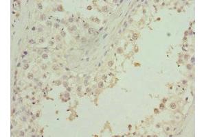 Immunohistochemistry of paraffin-embedded human testis tissue using ABIN7176258 at dilution of 1:100 (ZNF35 antibody  (AA 233-532))