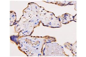 IHC analysis of ADK using anti-ADK antibody (ABIN7600222). (ADK antibody  (AA 165-351))