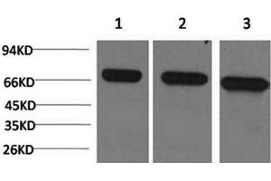 Western Blot analysis of 1) Hela, 2)Mouse brain, 3) Rat brain using HSPA8 Monoclonal Antibody at dilution of 1:2000. (Hsc70 antibody)