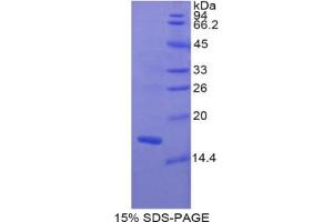 SDS-PAGE analysis of Rat MYL1 Protein. (MYL1 Protein)
