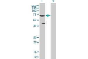 Western Blot analysis of CNKSR3 expression in transfected 293T cell line by CNKSR3 MaxPab polyclonal antibody.