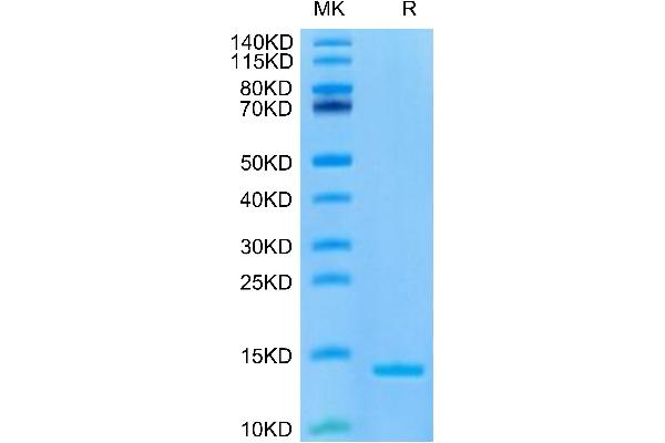 DDT Protein (AA 2-118) (His tag)