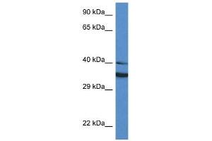 Western Blot showing NQO1 antibody used at a concentration of 1 ug/ml against HT1080 Cell Lysate (NQO1 antibody  (Middle Region))
