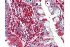 Anti-SCN1B antibody IHC staining of human small intestine. (SCN1B antibody  (AA 110-159))