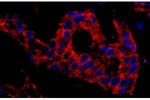 Immunohistochemistry (IHC) image for anti-Sorting Nexin 1 (SNX1) (C-Term) antibody (ABIN7449439) (Sorting Nexin 1 antibody  (C-Term))