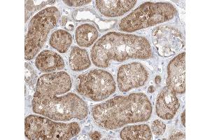 ABIN6266490 at 1/100 staining human kidney tissue sections by IHC-P.