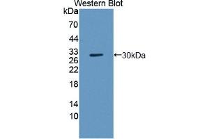 Western blot analysis of the recombinant protein. (TNPO2 antibody  (AA 17-248))
