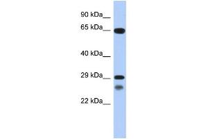 WB Suggested Anti-MYF5 Antibody Titration: 0. (MYF5 antibody  (C-Term))